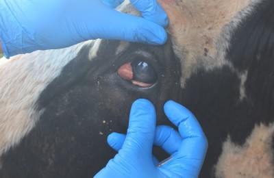 Tumor
