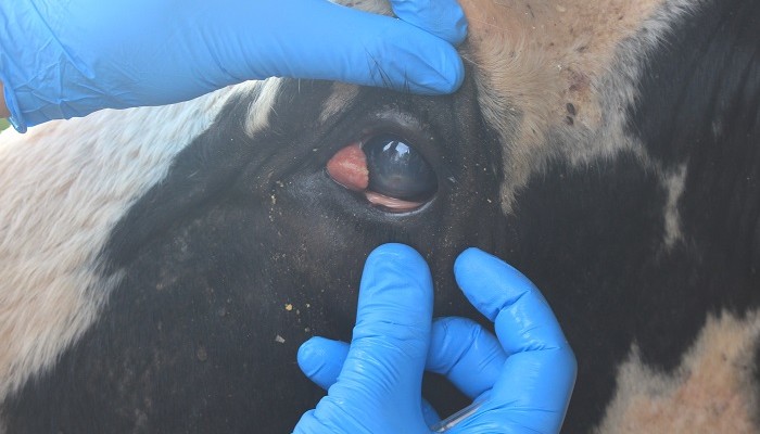 Tumor