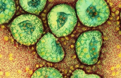 TEM of a cluster of corona viruses